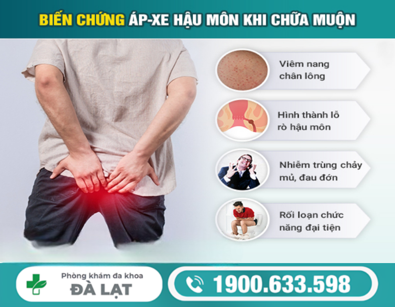 Hình ảnh minh họa
